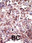 FNTA Antibody (C-term)
